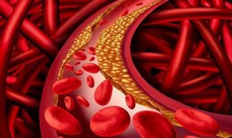 Những thủ phạm gây bệnh tử vong chỉ sau AIDS, nhiều người Việt 'chứa trọn bộ' Những thủ phạm gây bệnh tử vong chỉ sau AIDS, nhiều người Việt 'chứa trọn bộ'