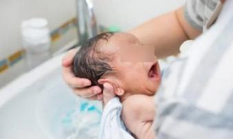 Vừa nhận con sơ sinh từ y tá đã thấy vết cắt ở đầu, mẹ phát hiện điều kinh hoàng Vừa nhận con sơ sinh từ y tá đã thấy vết cắt ở đầu, mẹ phát hiện điều kinh hoàng