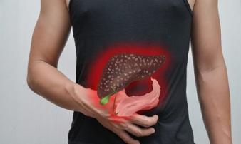 Cảnh báo từ vụ: Người đàn ông trẻ bị ung thư gan, đây là thói quen mà bác sĩ khuyến cáo phải bỏ ngay Cảnh báo từ vụ: Người đàn ông trẻ bị ung thư gan, đây là thói quen mà bác sĩ khuyến cáo phải bỏ ngay