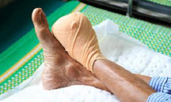 Làm sao để phòng căn bệnh “giết người” thầm lặng gây biến chứng mù mắt, cắt chân, ung thư Làm sao để phòng căn bệnh “giết người” thầm lặng gây biến chứng mù mắt, cắt chân, ung thư