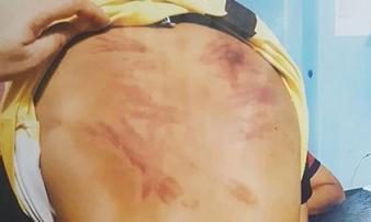 Vụ bé trai 11 tuổi bị thầy tu bạo hành: Lời kể đau thắt ngực của nạn nhân Vụ bé trai 11 tuổi bị thầy tu bạo hành: Lời kể đau thắt ngực của nạn nhân