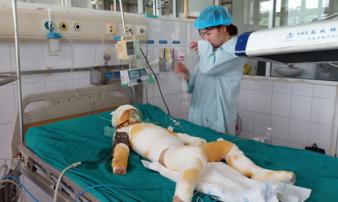 Vụ cô giáo đốt cồn dạy phòng chống cháy nổ: Nghẹn ngào lời kể của người mẹ trẻ Vụ cô giáo đốt cồn dạy phòng chống cháy nổ: Nghẹn ngào lời kể của người mẹ trẻ