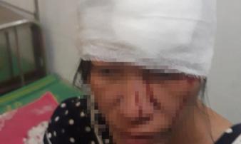 Hai đối tượng xông vào nhà hành hung khiến thai phụ trọng thương Hai đối tượng xông vào nhà hành hung khiến thai phụ trọng thương