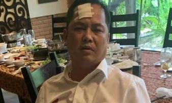 Vụ giang hồ vây xe chở công an: Người bị đánh 'phản pháo' Vụ giang hồ vây xe chở công an: Người bị đánh 'phản pháo'