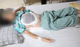 Thấy hạch ở nách, dấu hiệu ung thư di căn mà không biết Thấy hạch ở nách, dấu hiệu ung thư di căn mà không biết