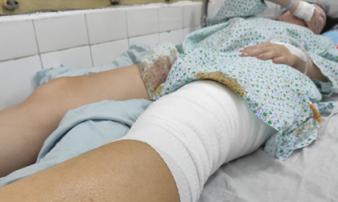 Nữ cổ động viên kể khoảnh khắc bị pháo sáng ném vào chân ở Hàng Đẫy Nữ cổ động viên kể khoảnh khắc bị pháo sáng ném vào chân ở Hàng Đẫy