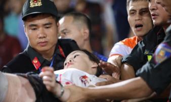 Khởi tố điều tra vụ bắn pháo sáng vào nữ CĐV trên sân Hàng Đẫy Khởi tố điều tra vụ bắn pháo sáng vào nữ CĐV trên sân Hàng Đẫy