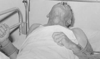 Căn bệnh đáng sợ, đã mắc phải là tử vong: Bác sĩ khuyên bạn điều này Căn bệnh đáng sợ, đã mắc phải là tử vong: Bác sĩ khuyên bạn điều này