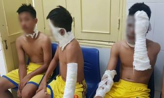 Chùm bóng bay phát nổ khiến nhiều người của CLB Sông Lam Nghệ An nhập viện Chùm bóng bay phát nổ khiến nhiều người của CLB Sông Lam Nghệ An nhập viện