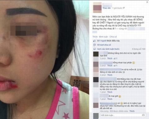 co-gai-ha-thanh-bi-ban-trai-danh5