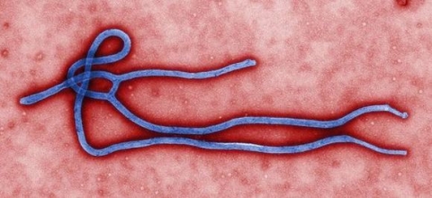 hinh-anh-anh-huong-ghe-gom-cua-dich-ebola-12