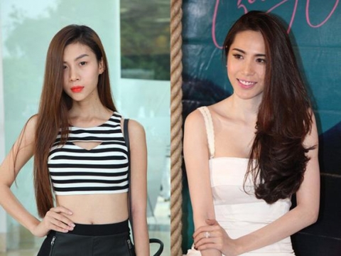 nhung-truong-hop-giong-nhau-vi-phau-thuat-tham-my-trong-showbiz1