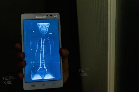 Cậu bé 11 tuổi liệt toàn thân giành HCV Toán học trẻ quốc tế - 2