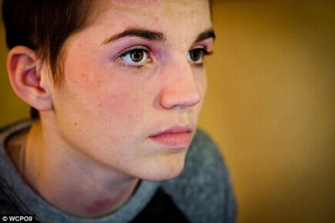 Cô gái 16 tuổi hồi phục nhanh kỳ diệu sau vụ cháy kinh hoàng