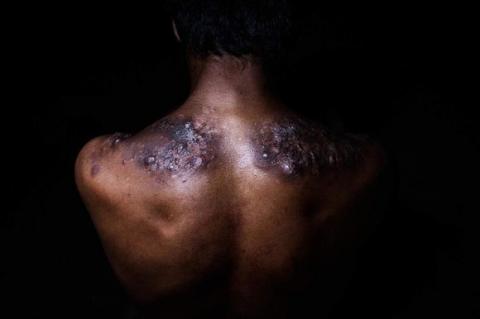  Cuộc sống mưu sinh khốn khổ của người thợ khai thác lưu huỳnh