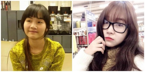 Khác lạ hình ảnh trước và sau phẫu thuật của 10 cô gái Việt