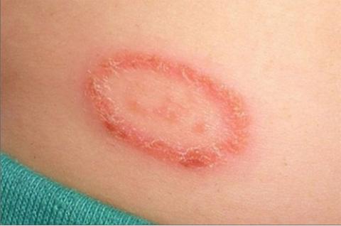 Những điều cấm kị trong cách xử lý kiến ba khoang - 1