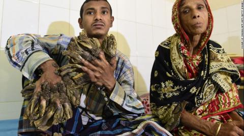 Người đàn ông có 