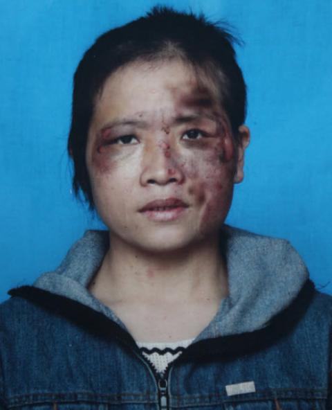 Nghệ An: Chồng tra tấn vợ dã man - 1