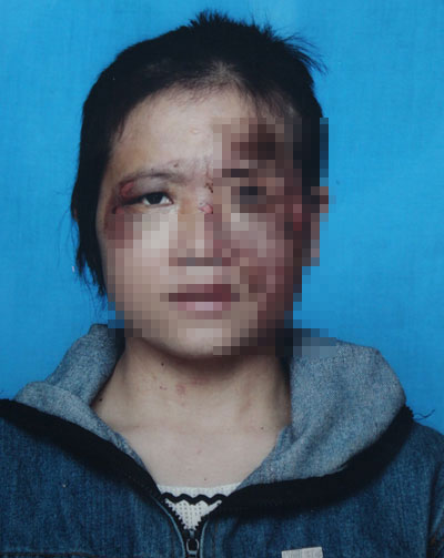 Vụ chồng tra tấn vợ: Vì “chát chít” trên mạng - 1