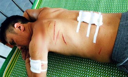 truysat-xahoi.com.vn-1458611479