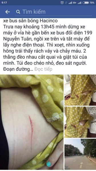 Hà Nội: Cô gái trẻ bị rạch đùi, cướp túi xách ngay giữa ban ngày? - Ảnh 1.