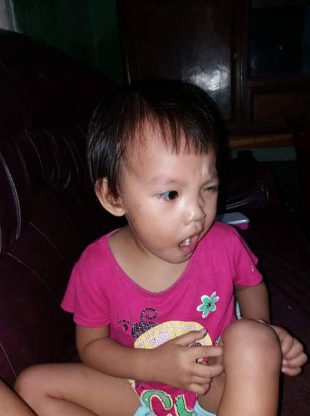 Sai lầm của mẹ khiến con bị liệt mặt, méo miệng khi trời lạnh - Ảnh 1.