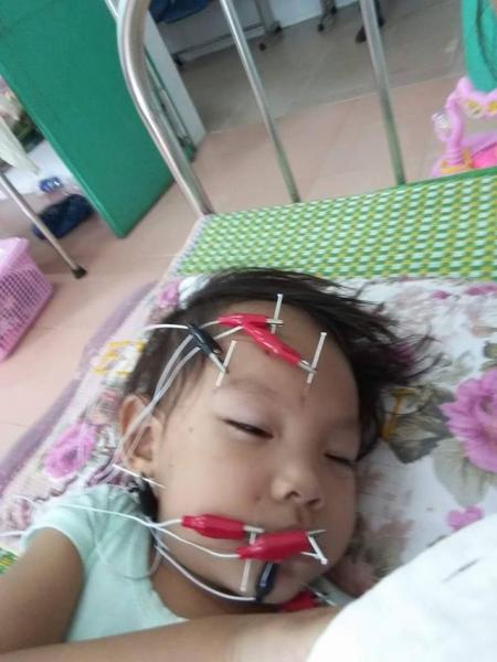 Sai lầm của mẹ khiến con bị liệt mặt, méo miệng khi trời lạnh - Ảnh 3.