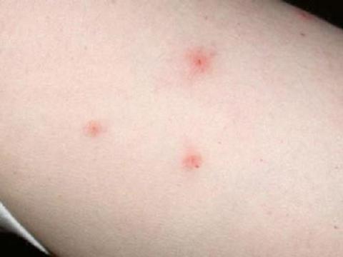 Tác dụng tuyệt vời của chanh mật ong và cách ngâm chuẩn xác nhất Tac dung tuyet voi cua chanh mat ong va cach ngam chuan xac nhat