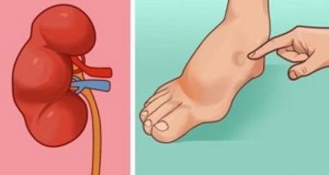 dấu hiệu cảnh báo đột quỵ 0 dấu hiệu cảnh báo đột quỵ 0