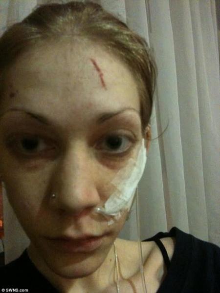 tu mot bo xuong kho di dong sap chet, co gai da lot xac ngoan muc sau 18 thang - 2