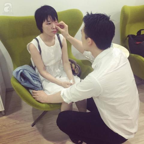  Hình ảnh mới sau khi tái tạo da của cô sinh viên bị tạt axit bỏng đến 75% gương mặt năm ngoái - Ảnh 3.