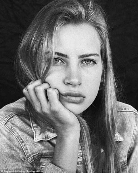 ung thu giai doan 4 voi 17% co hoi song sot, co gai 16 tuoi da danh bai khoi u 'lon bang co tay' day bat ngo - 2