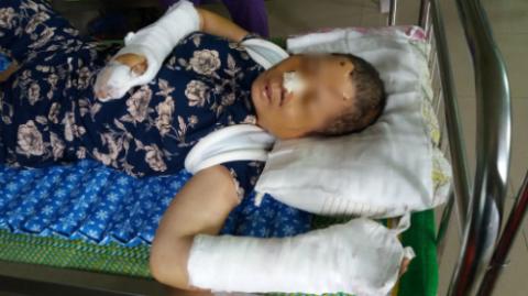 chong tra tan vo nhu thoi trung co roi cua tay tu tu vi ghen tuong - 2