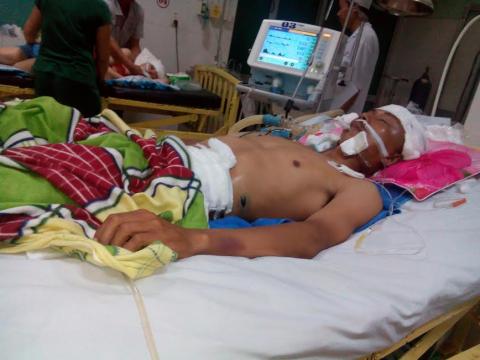 Gia Lai: Khởi tố vụ án đánh người dẫn đến chấn thương sọ não