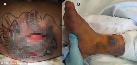 Vết xăm chưa lành đã vội vàng đi bơi, người đàn ông phải đánh đổi bằng cả mạng sống - Ảnh 2. Vết xăm chưa lành đã vội vàng đi bơi, người đàn ông phải đánh đổi bằng cả mạng sống - Ảnh 2.
