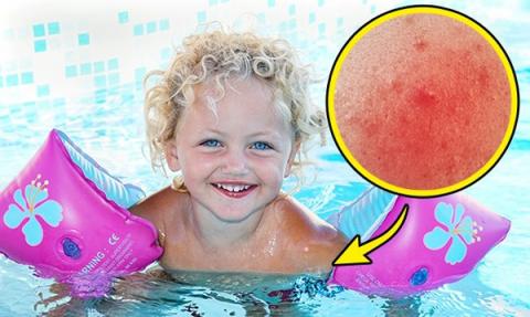 diem mat loat do choi 