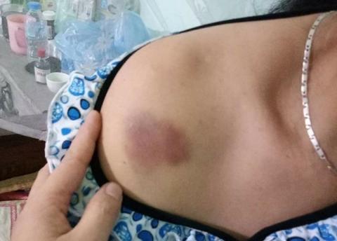 Trần tình của 2 người phụ nữ bị đánh bầm dập vì nghi bắt cóc trẻ con - 3