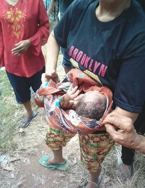 Indonesia: Phát hiện một bé trai sơ sinh bị chôn vùi dưới hố rác lớn - Ảnh 3.