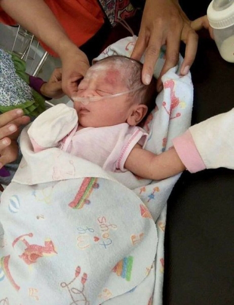 Indonesia: Phát hiện một bé trai sơ sinh bị chôn vùi dưới hố rác lớn - Ảnh 4.