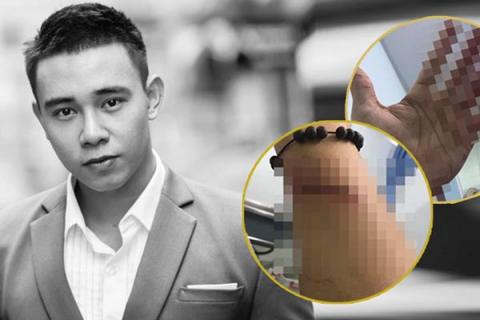 dong hung tra no (2)