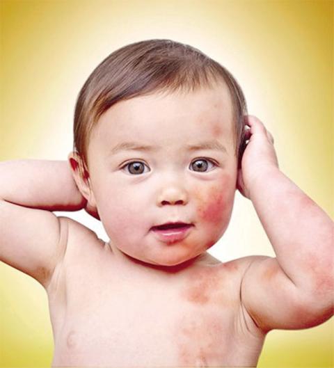 10 bệnh trẻ hay gặp lúc giao mùa và cách phòng tránh - 3