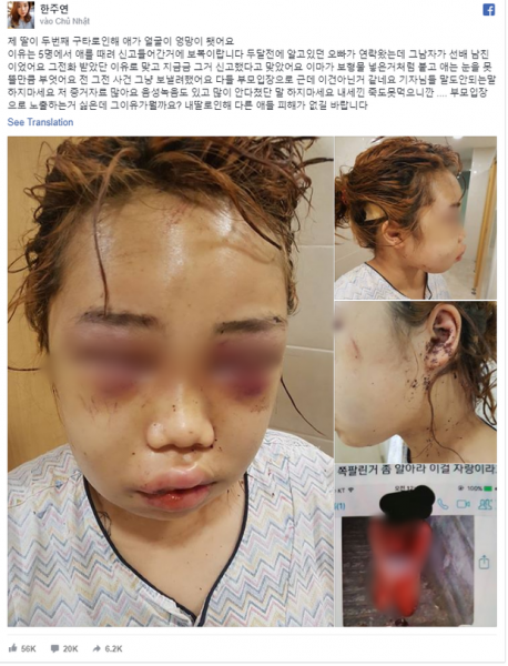 Thêm thông tin chi tiết về vụ nữ sinh 14 tuổi bị bạo hành gây rúng động Hàn Quốc những ngày qua - Ảnh 4.