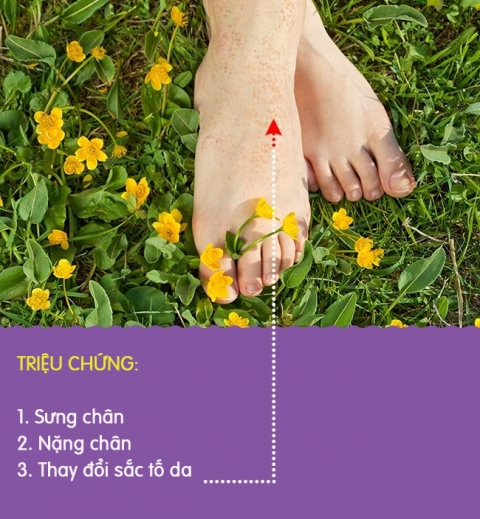 8 biểu hiện khác lạ ở chân là dấu hiệu cảnh báo có thể bạn đang gặp bệnh nghiêm trọng - Ảnh 3.
