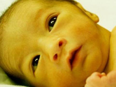 Phân của trẻ đổi màu, cha mẹ cần nghĩ tới bệnh cực kỳ nguy hiểm này - 1