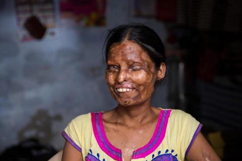 Xót xa 2 mẹ con dù bị tra tấn dã man vẫn phải sống với người chồng “ác quỷ” - 1