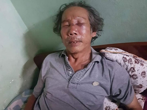 Bảo vệ chung cư Sài Gòn đánh ông già 68 tuổi rách mặt, gãy sống mũi vì đậu xe sai quy định - Ảnh 1.