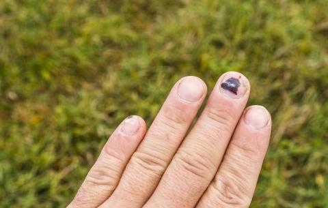 6 dau hieu khac la cua mong tay tuong don gian nhung cuc nguy hiem - 3