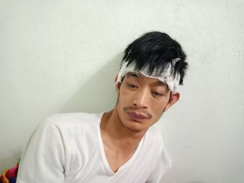  Bị đánh khiến anh Điềm vẫn choáng váng.