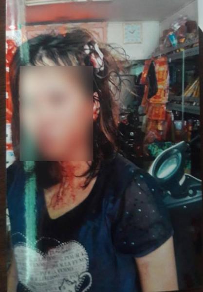 tp.hcm: vo bi bo nhi cua chong danh ghen nguoc, dung tuyp sat danh dap da man - 1